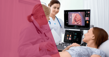 Imagem Destacada - Como escolher o melhor equipamento de ultrassom